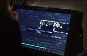 set para​una película​